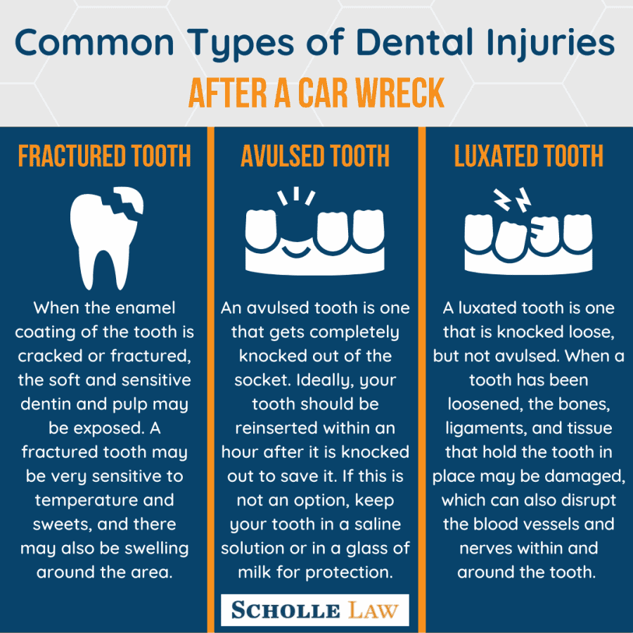 Common Types of Dental Injuries After a Car Wreck