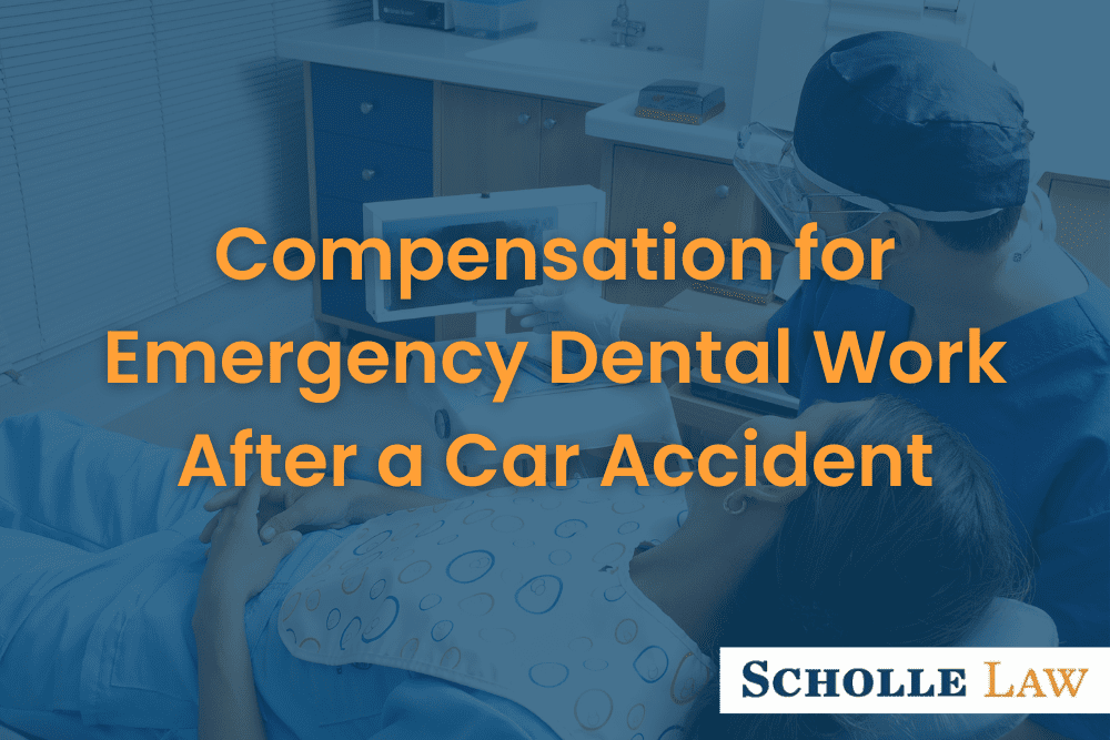 Compensation for Emergency Dental Work After a Car Accident