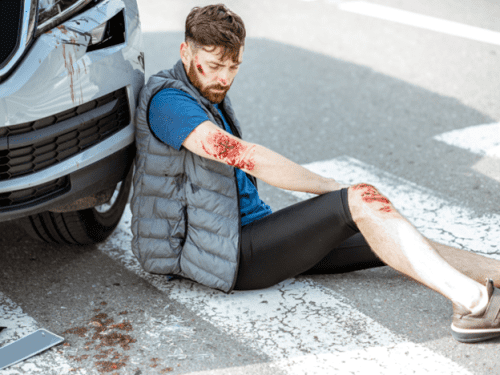 man with road rash after a car accident