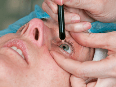 doctor performing eye procedure