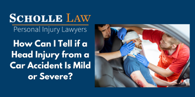 How Can I Tell if a Head Injury from a Car Accident Is Mild or Severe? 28 head injury mild or severe1