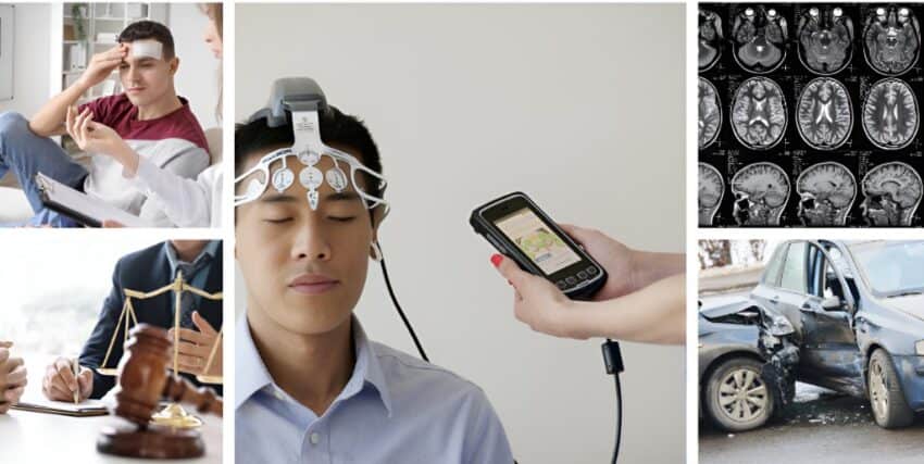 Signs and Symptoms of a Brain Injury