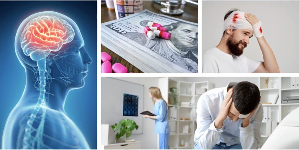 Steps to Take After a Brain Injury
