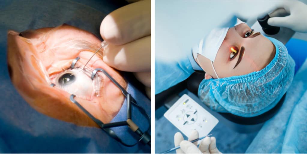 Limitations and Pitfalls of Telemedicine in Ophthalmology